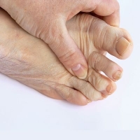 Osteoarthritis Foot Pain